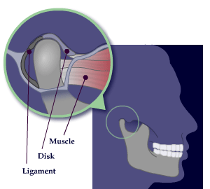 illustration of the temporomandibular joint